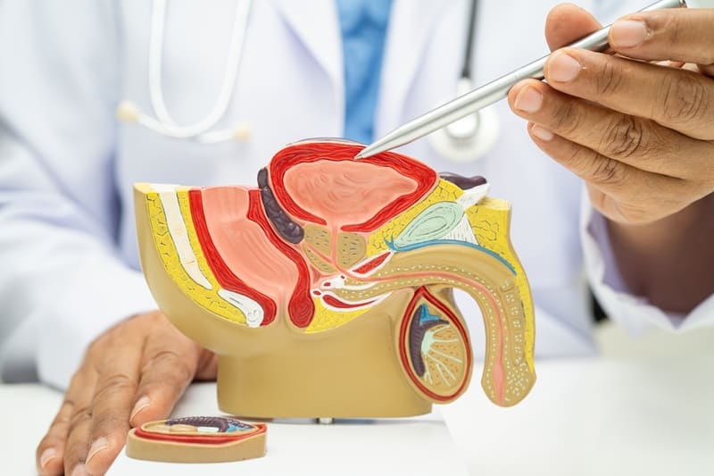 Cáncer de próstata