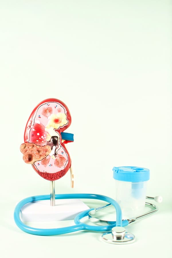 Servicio de urología para cálculos renales en Bogotá